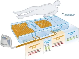 xtech 25 therapeutische matratze